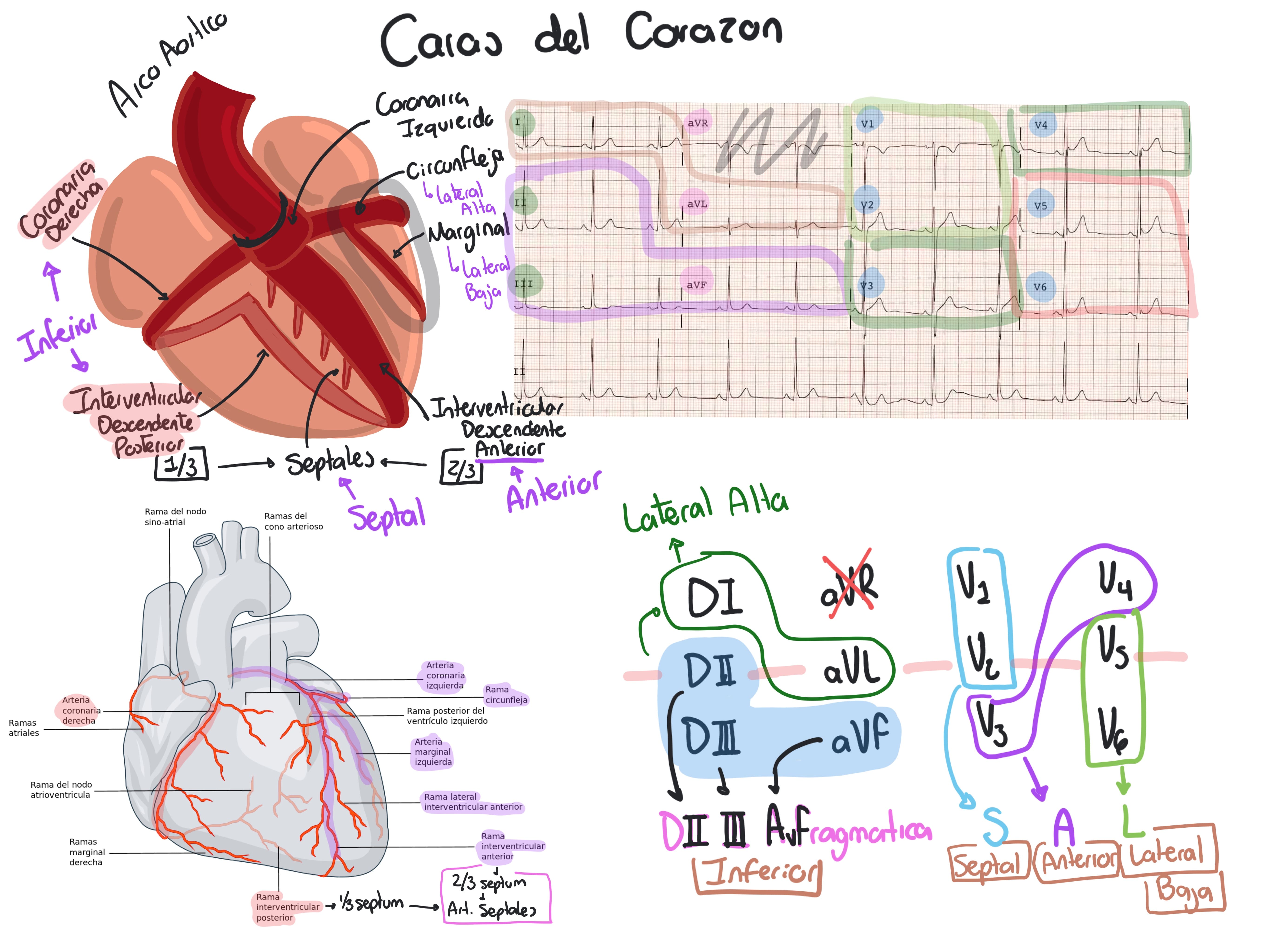 Video EKG - stumed 13 COVID
